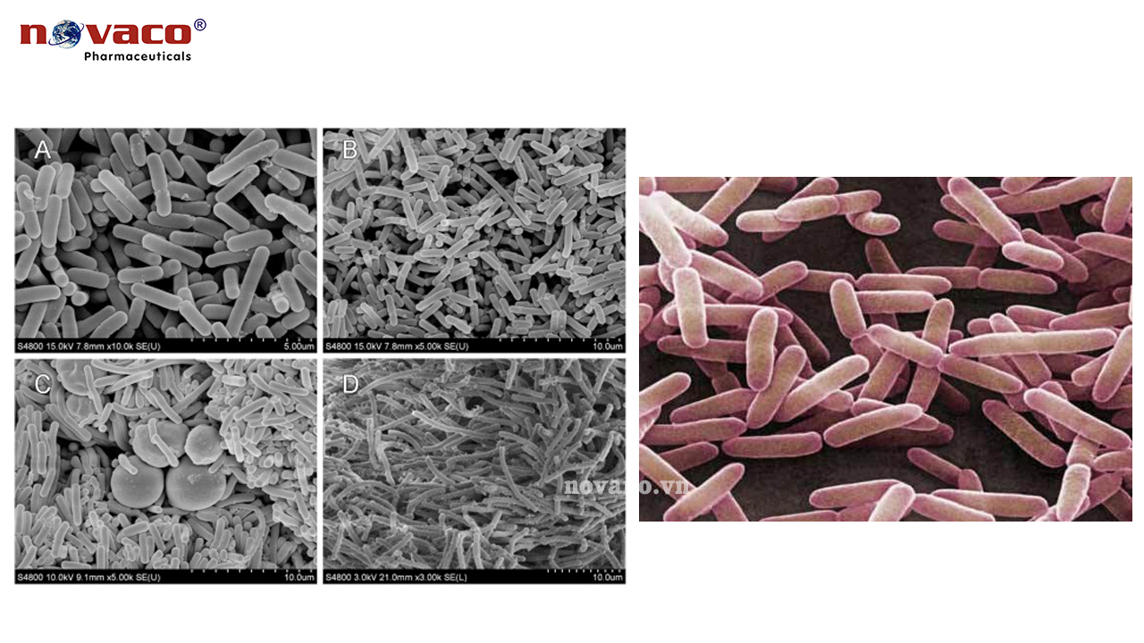 Men Lactobacillus kefir